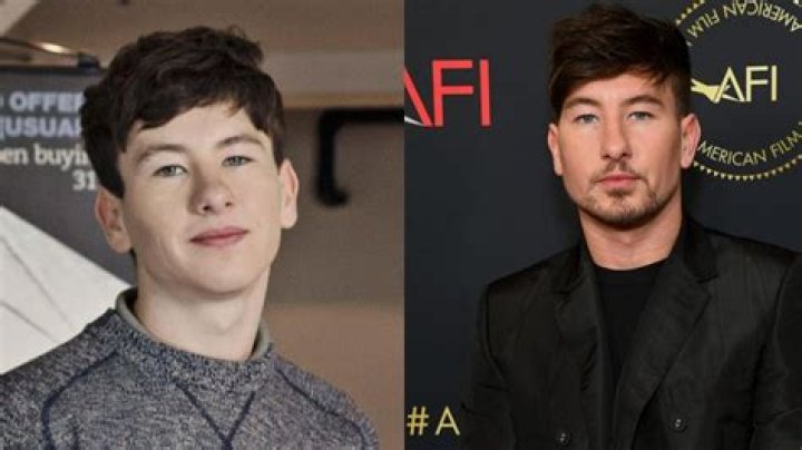 Barry Keoghan's Nose Job: Everything You Need To Know
