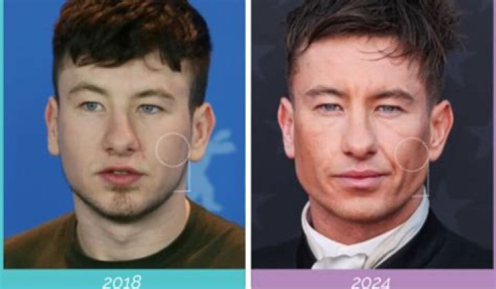 Barry Kepghan: Plastic Surgery Pioneer And Visionary