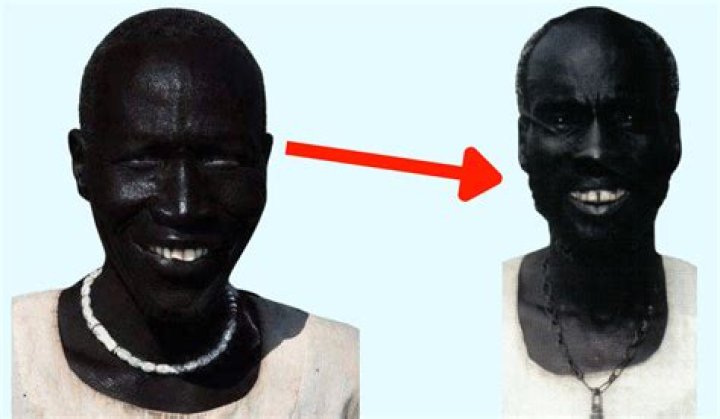 Meet The Darkest Man Alive: A True Story Of Melanin And Medical Marvels