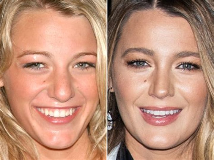 Blake Lively's Mesmerizing Almond-Shaped Eyes: A Guide To Her Eye Shape