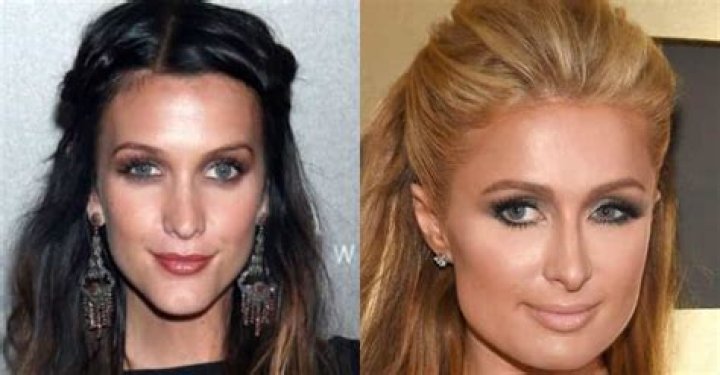 Spotlight On Celebrities Embracing Strabismus: A Unique Perspective On Beauty