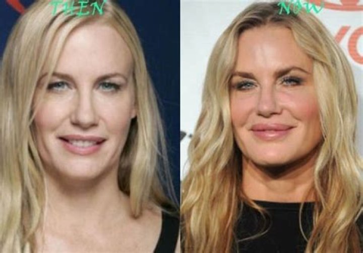 Daryl Hannah's Plastic Surgery Journey: Before And After