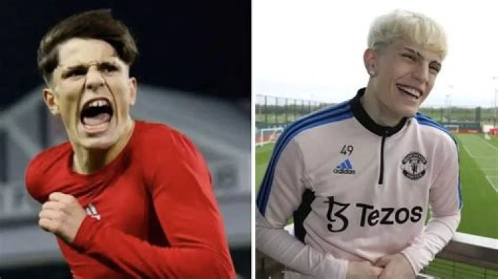 Top Garnacho Face Surgery: Before And After Results