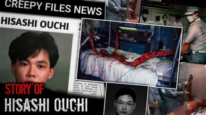 The Full Story Of Hisashi Ouchi: The Man Who Suffered The World's Worst Nuclear Accident