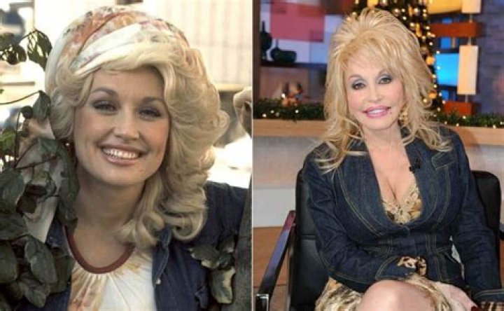 Unveiling Dolly Parton's Plastic Surgery Secrets: Exploring The Extent Of Her Enhancements