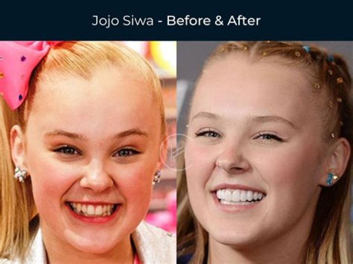 Unveiling The Enigma Of JoJo Siwa's Youthful Adventure
