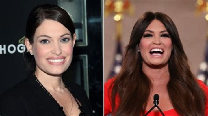 Kimberly Guilfoyle's Transformation: Before The Knife