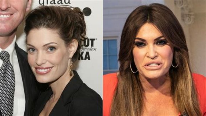 Kimberly Guilfoyle's Appearance Criticized: Why She Looks So Bad
