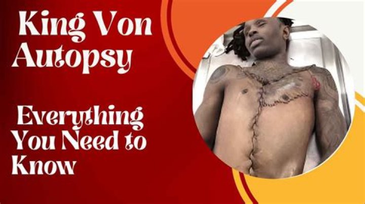Graphic Warning: Shocking Autopsy Photos Of Rapper King Von