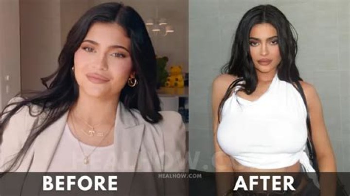 Kylie Jenner's Ultimate Weight Loss Plan For 2024