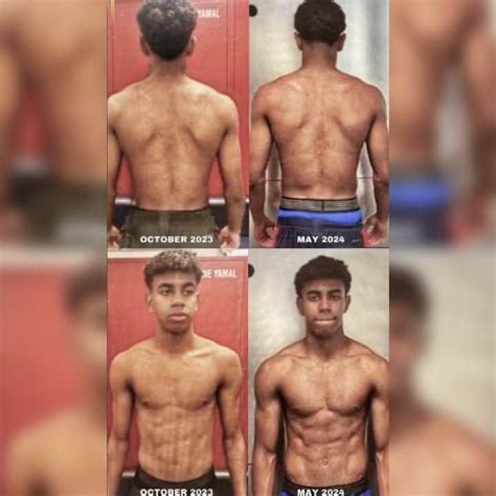 The Essential Guide To The Laminated Yamal Muscle: Functions, Anatomy, And Clinical Significance