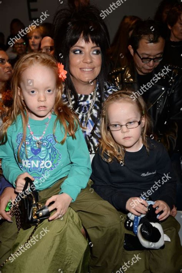 Lily Allen Talks Candidly About Her Daughter's Forehead