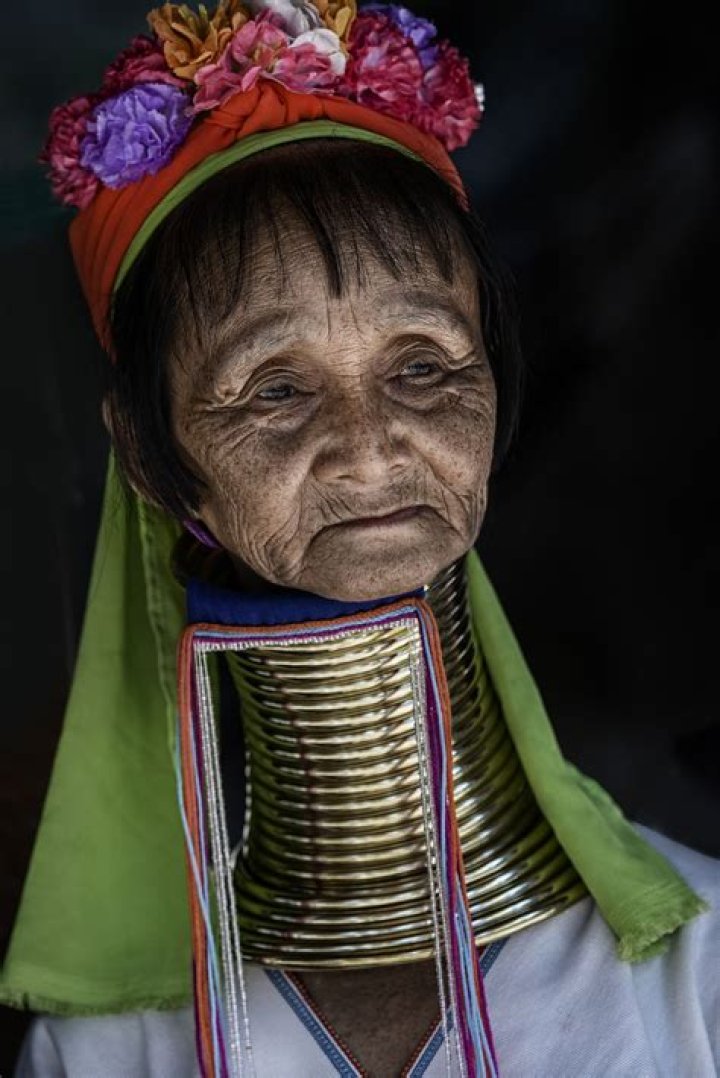 The Intriguing World Of Necks: Individuals With Extraordinary Cervical Length