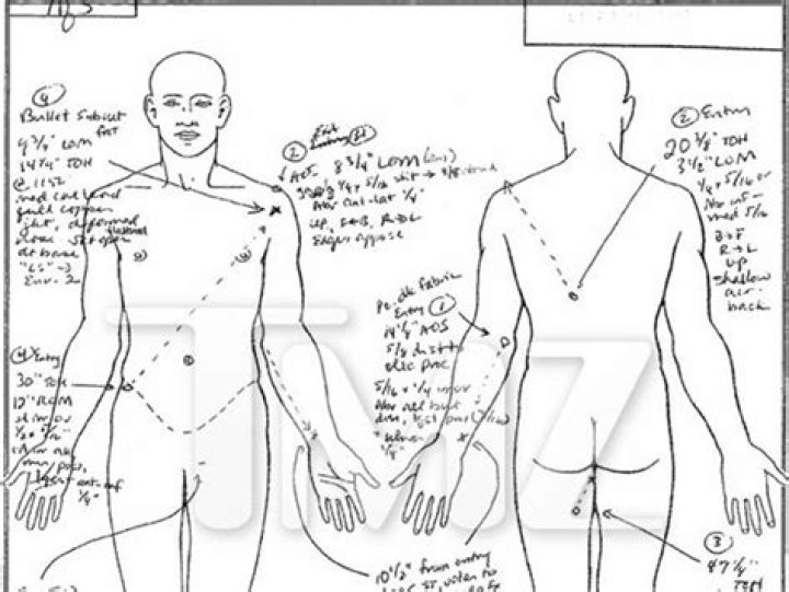 Top 5 Unsolved Rappers' Autopsy Reports