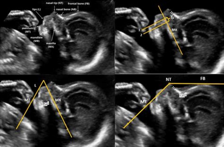 Unveiling Robin Meade's Measurements: Discoveries And Insights
