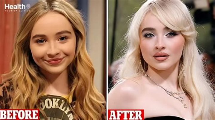 Before And After: Sabrina Carpenter's Transformation Over Time