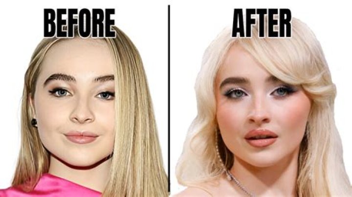 Sabrina Carpenter Debuts Drastic Face Transformation: Unveiling The Secrets Behind Her Striking Makeover