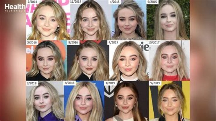 The Surprising Truth About Sabrina Carpenter's Recent Surgery